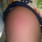 baby shots 
